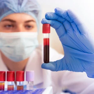 Woman lab worker holding test tube doing blood analysis, modern laboratory, blurred face